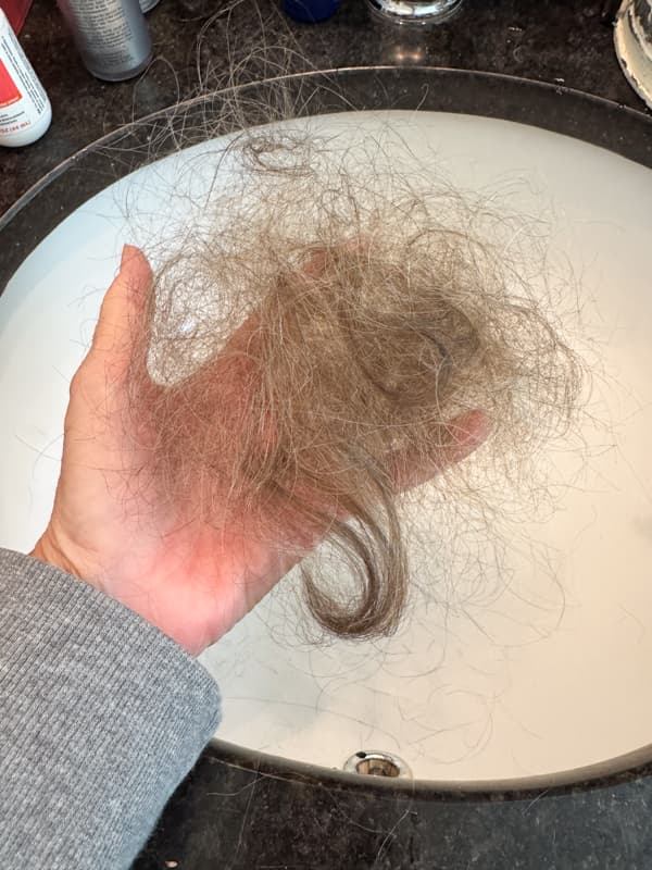 Hair loss in one comb through